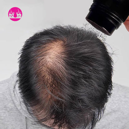 🔥KOOP 1, KRIJG 1 GRATIS💝Haarverdikkend haarvezelpoeder